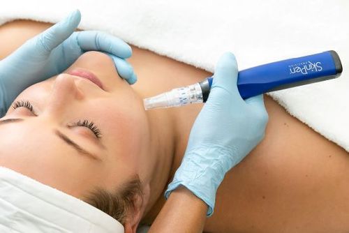 Microneedling